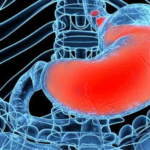 Adverse Reactions increased in children due to use of common Reflux Aids_ Finds study
