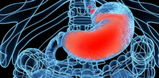 Adverse Reactions increased in children due to use of common Reflux Aids_ Finds study