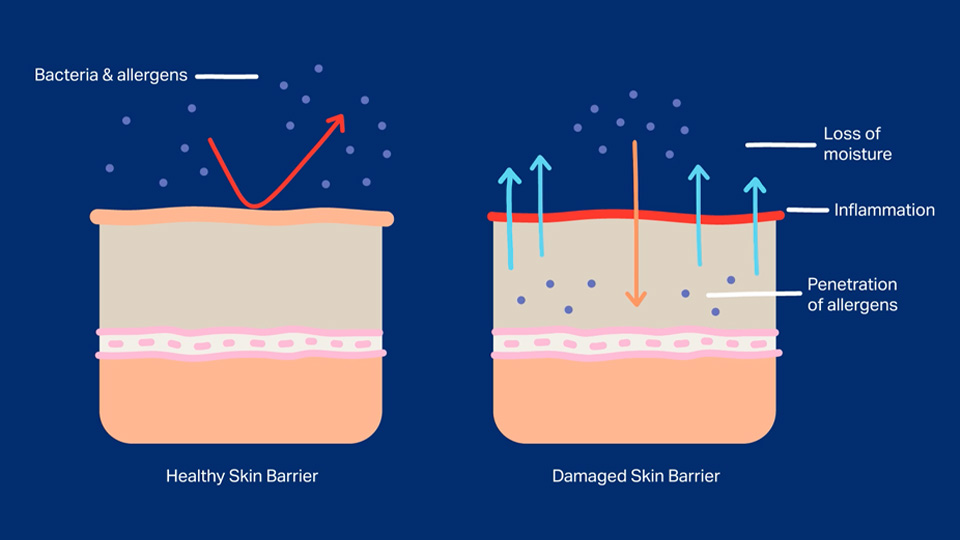 Improves Skin Barrier
